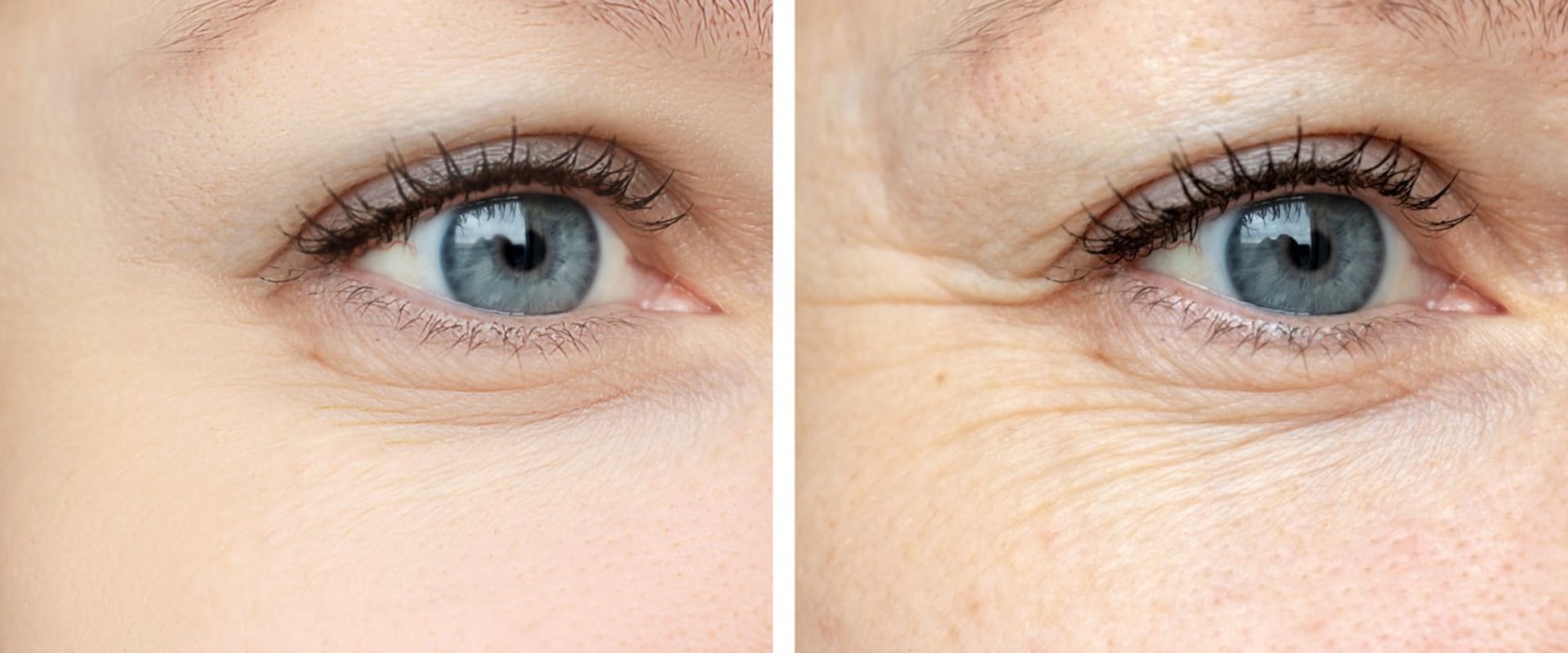 How to Prevent Wrinkles and Fine Lines