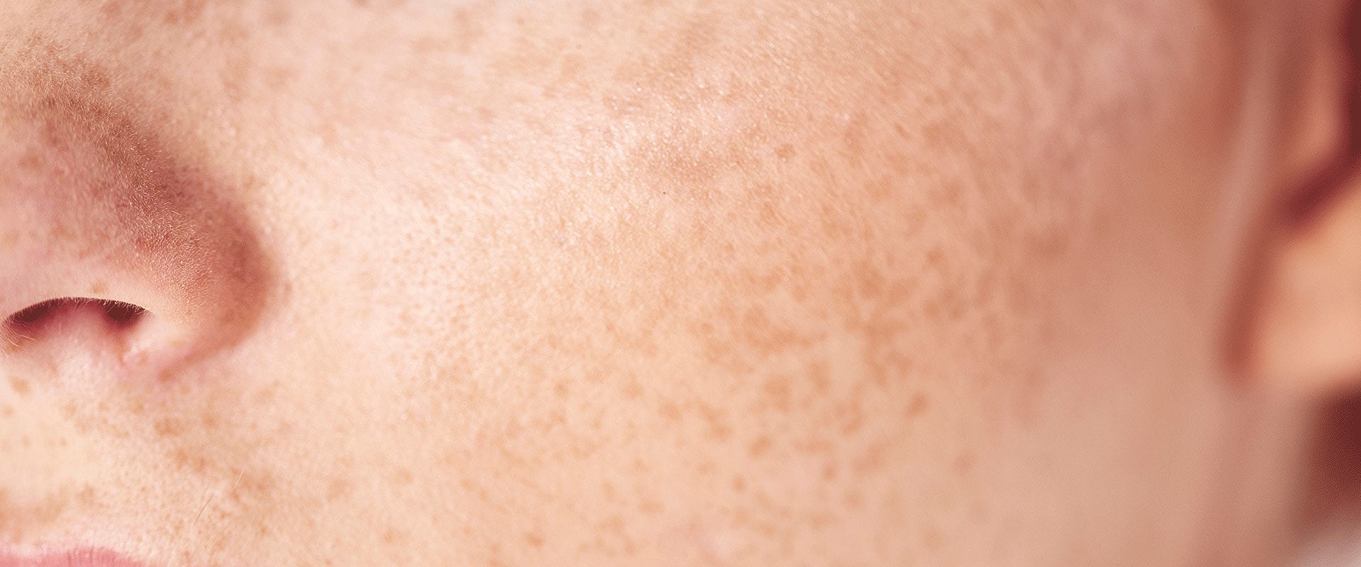 Sensitive Skin: Understanding the Causes, Symptoms, and Treatment