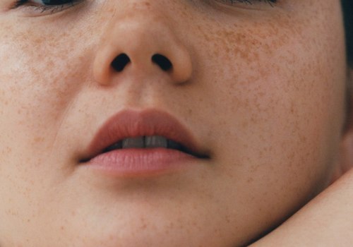 Normal Skin: A Comprehensive Look